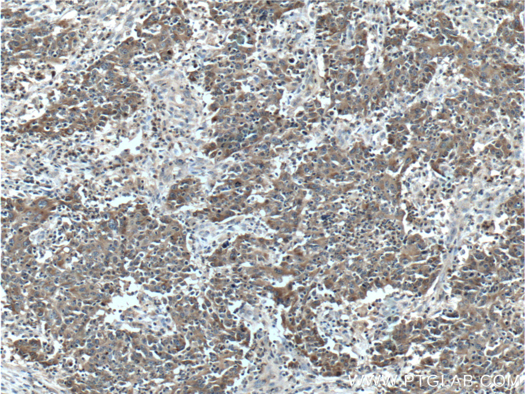 LCN2 Polyclonal antibody