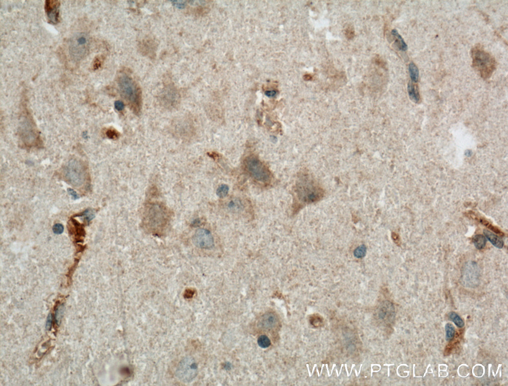 LRRTM3 Polyclonal antibody