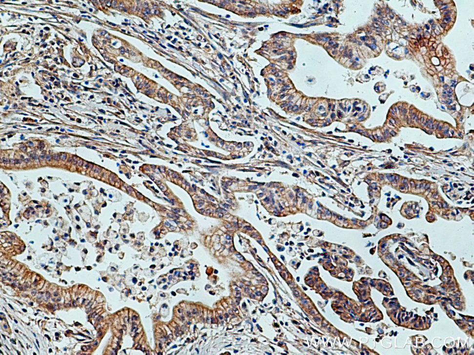 TRIM26 Polyclonal antibody