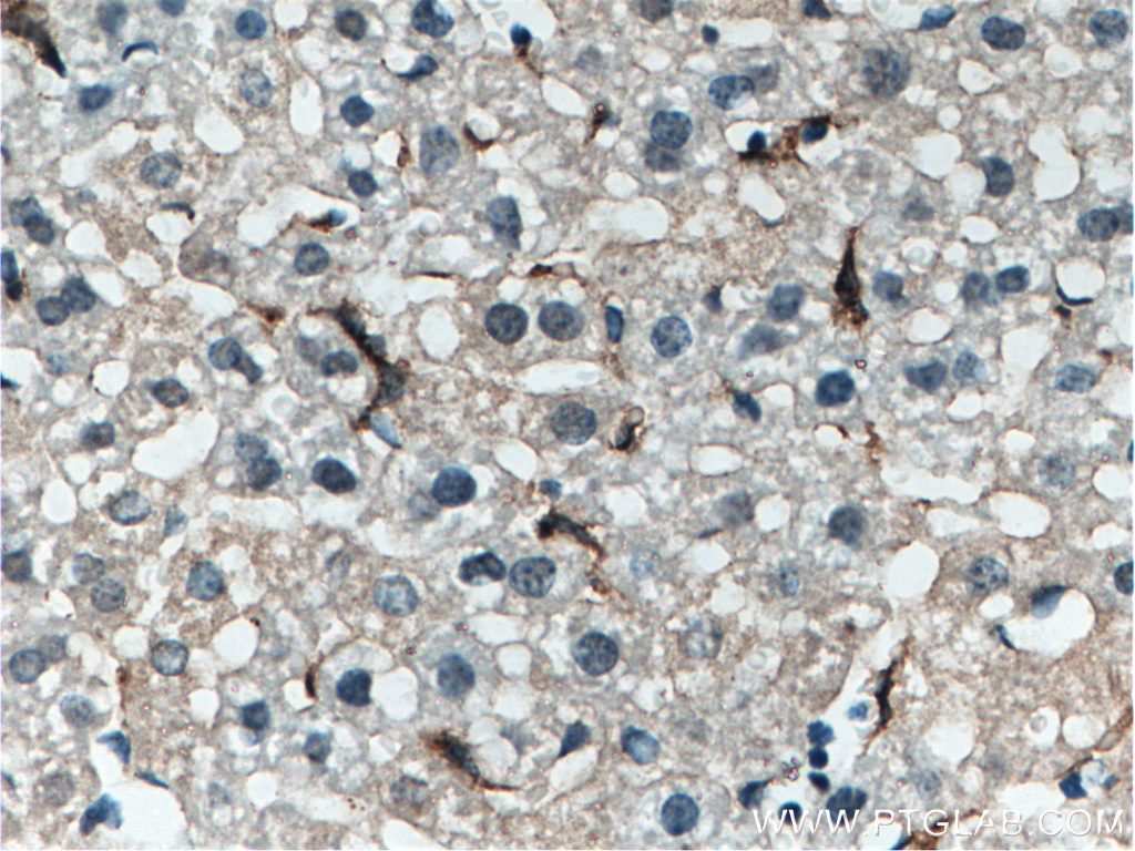 EMR1 Polyclonal antibody