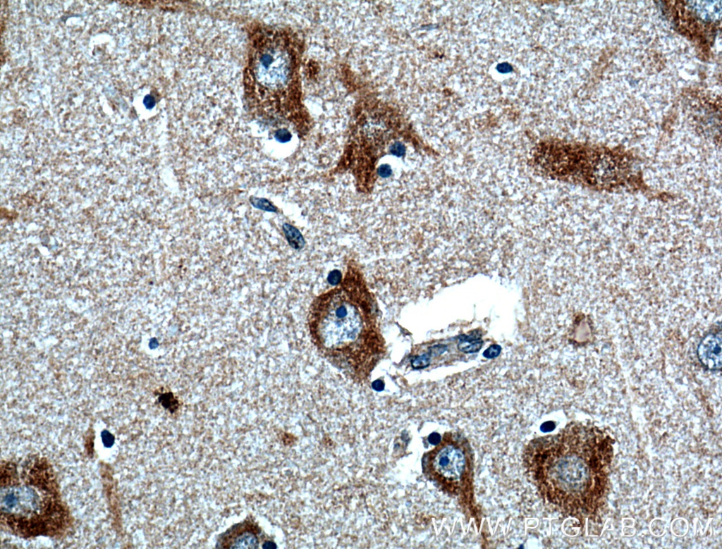 FIBIN Polyclonal antibody