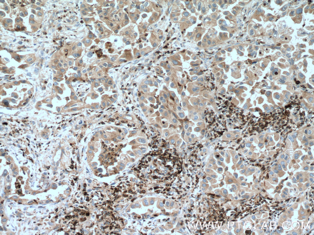 FBP17 Polyclonal antibody