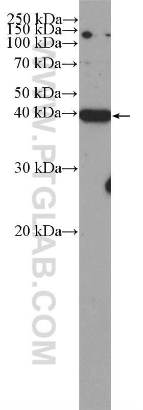 CDK5R2/p39 Polyclonal antibody