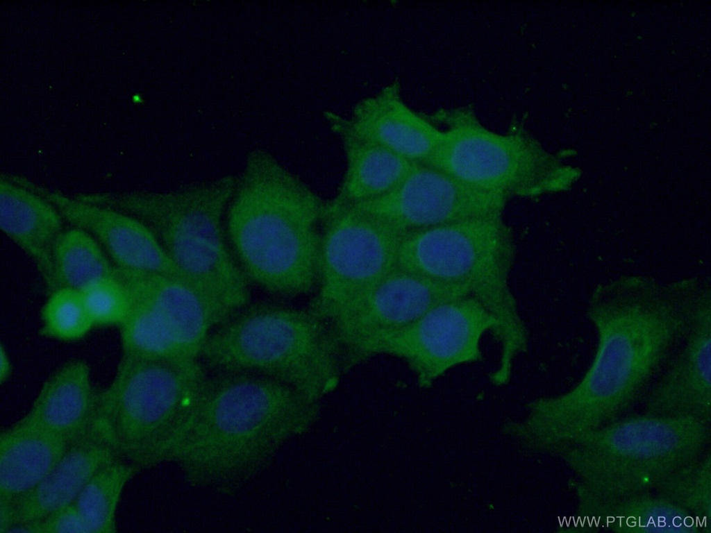 TRAIL Polyclonal antibody