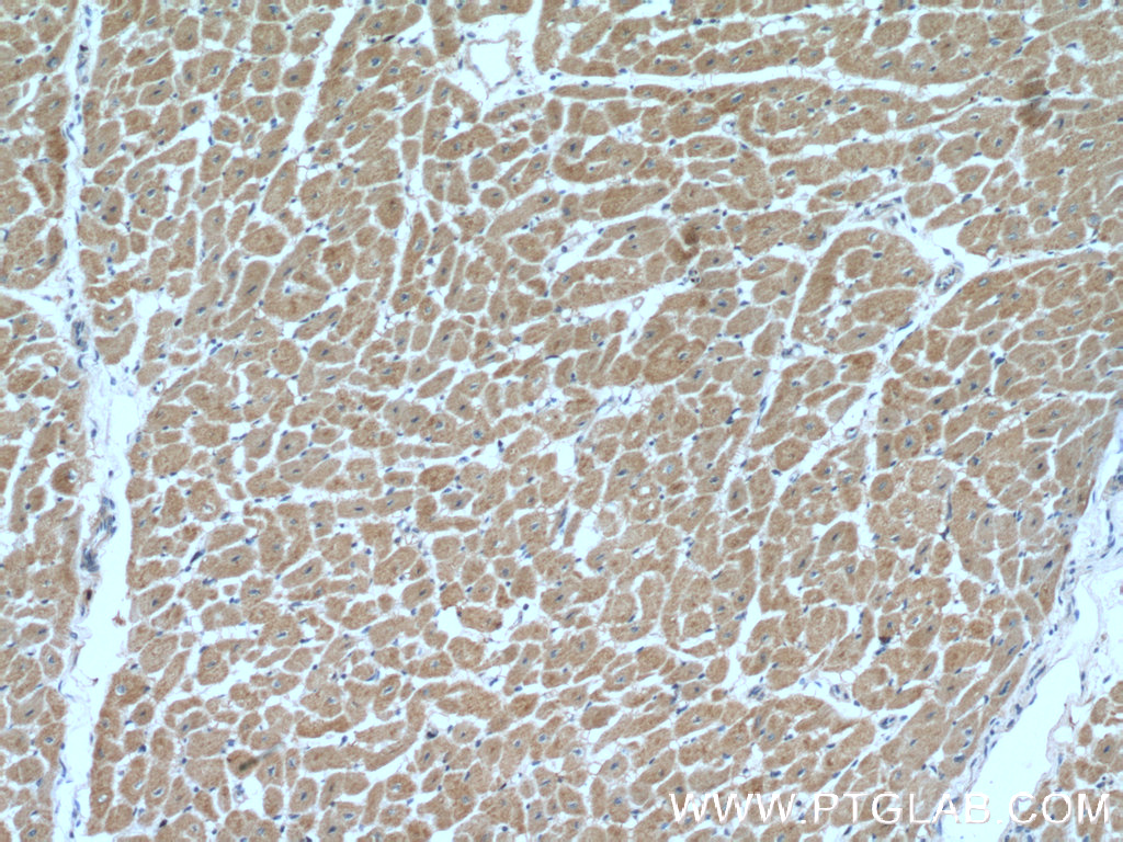 AHNAK2 Polyclonal antibody