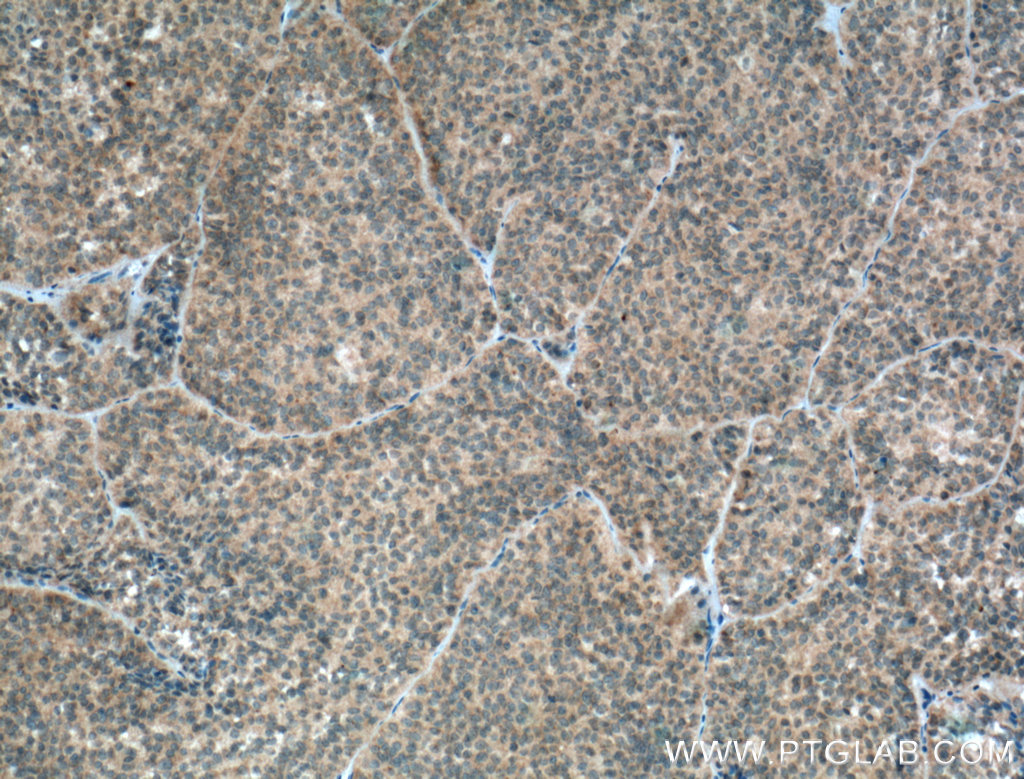 GH1 Polyclonal antibody