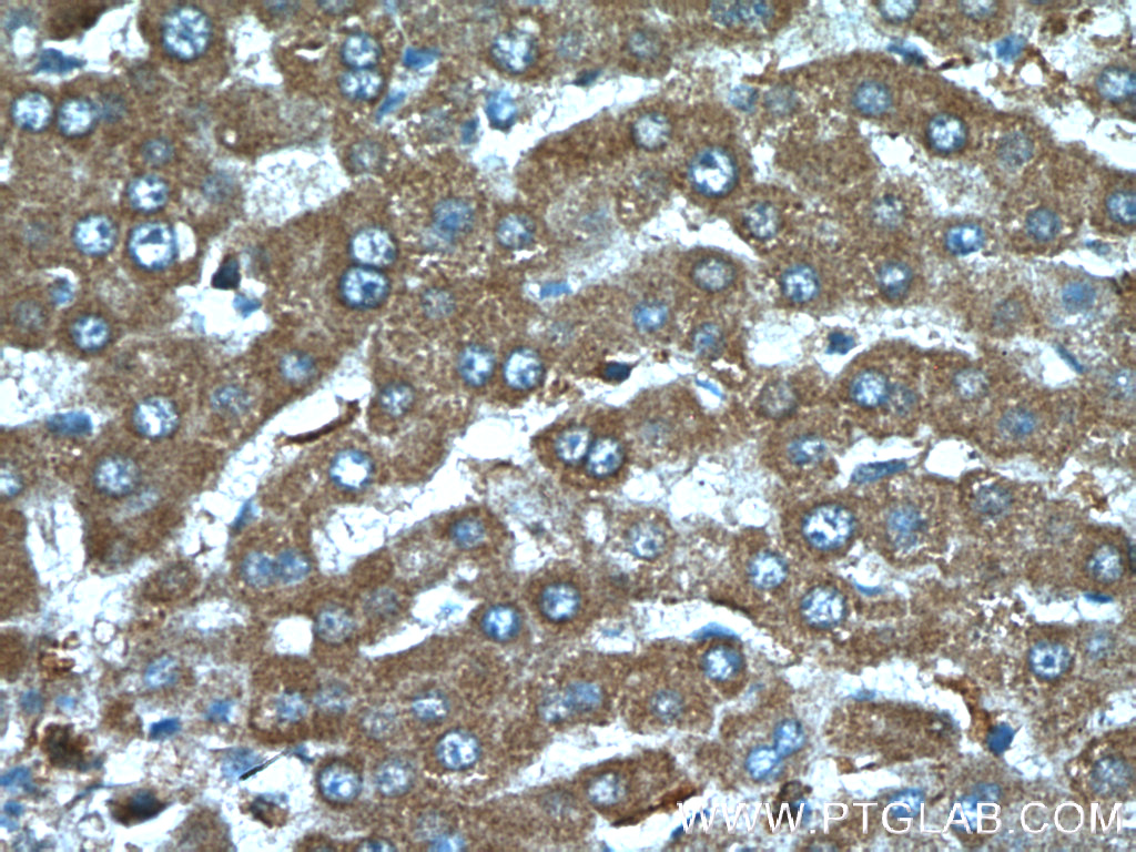TTPA Polyclonal antibody