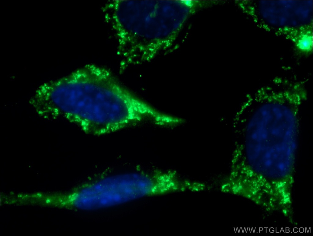 RAB10 Polyclonal antibody