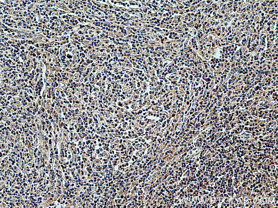 CXCL8/IL-8 Polyclonal antibody