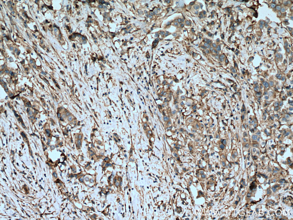 Integrin Alpha V Polyclonal antibody