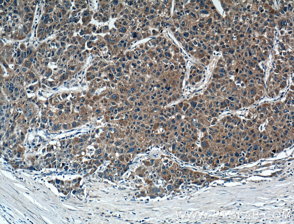 FGF3 Polyclonal antibody