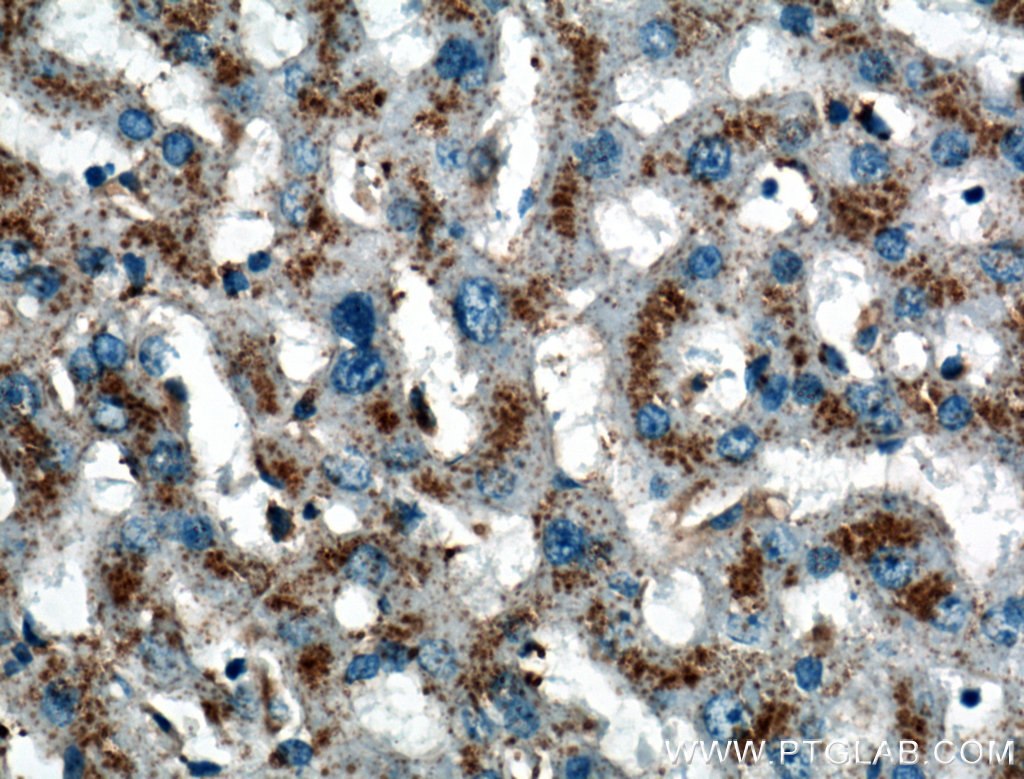 LIMPII Polyclonal antibody