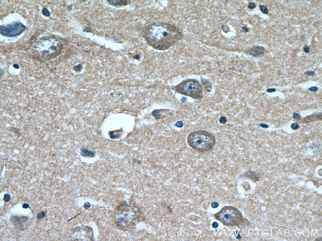 KCNK4 Polyclonal antibody