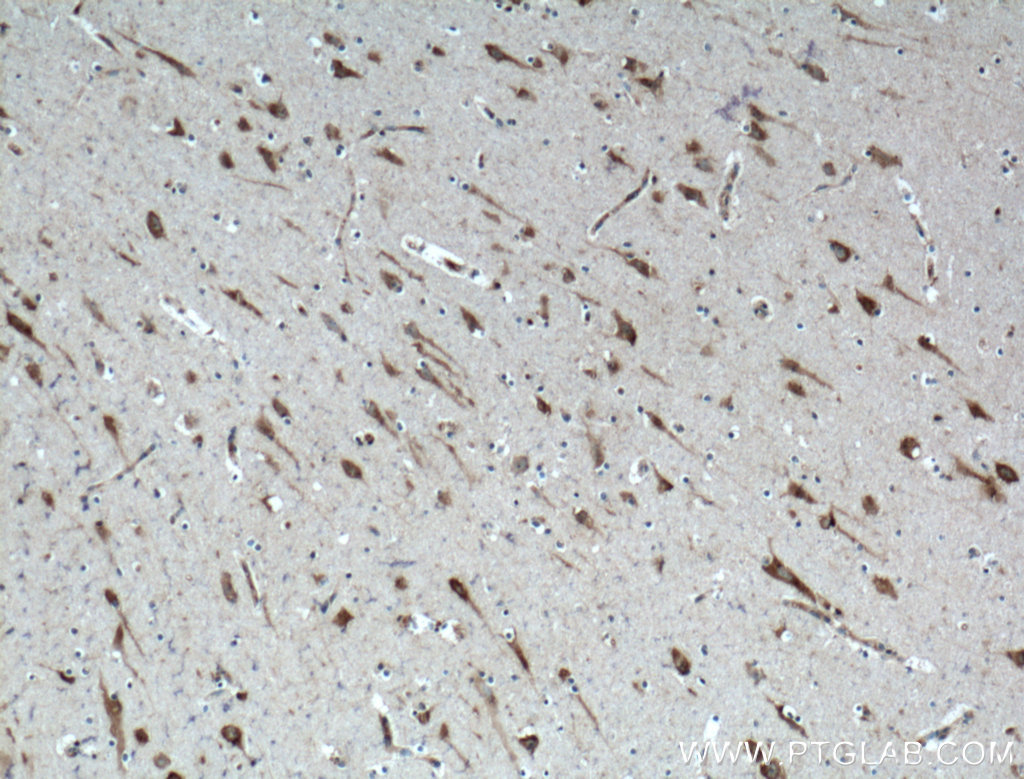 PTN Polyclonal antibody
