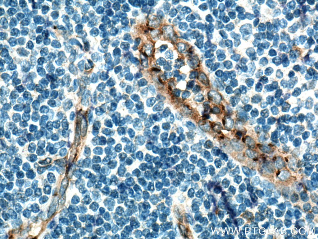 NOS3 Polyclonal antibody
