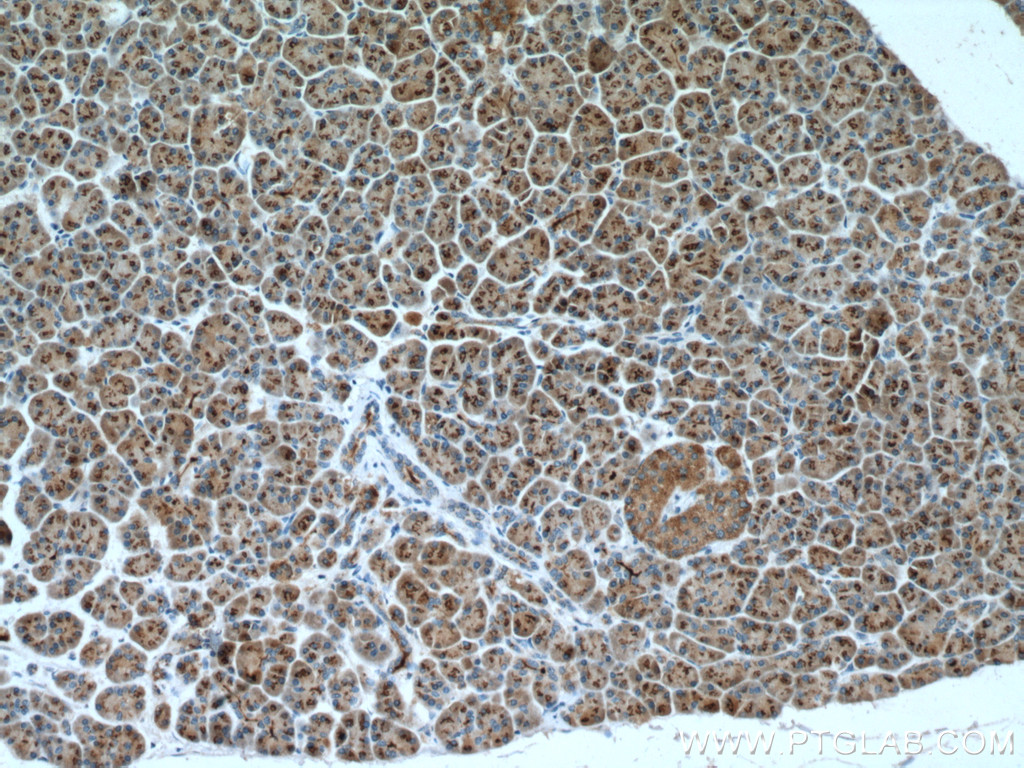 FAM3B Polyclonal antibody