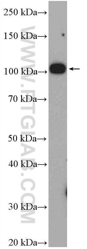 Nesprin 3 Polyclonal antibody