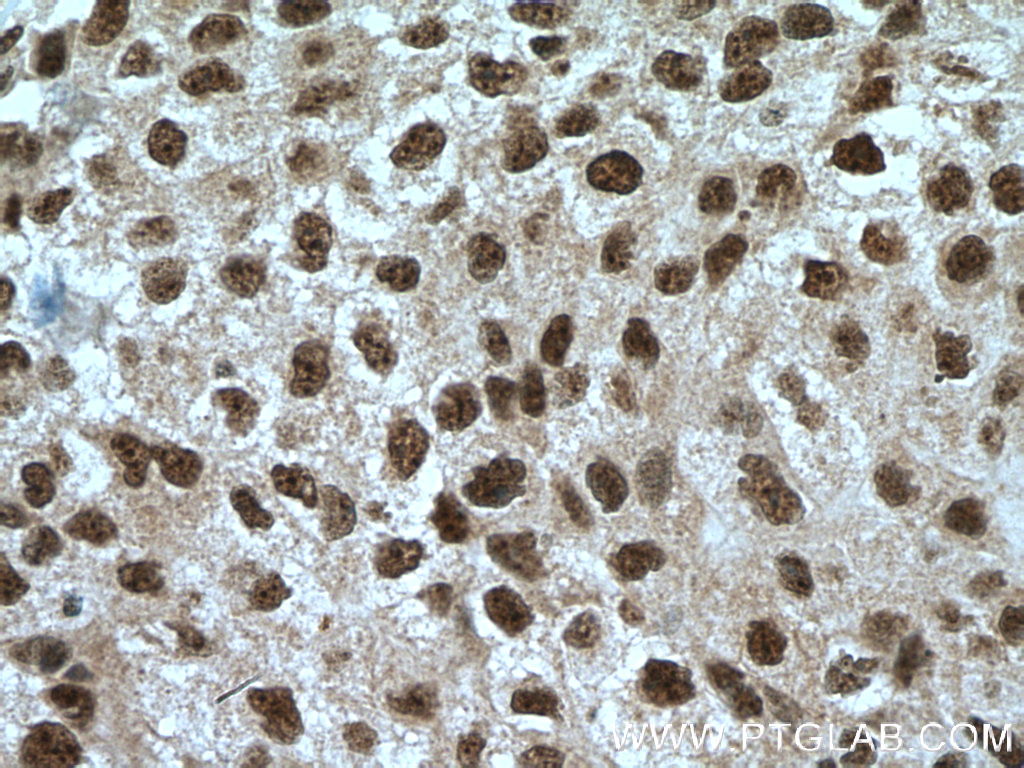 NEK1 Polyclonal antibody