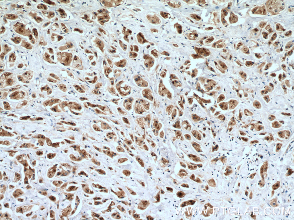 SGSM3 Polyclonal antibody