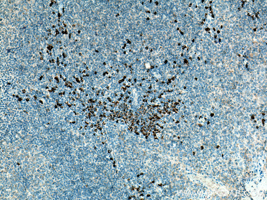 CSF2RB Polyclonal antibody