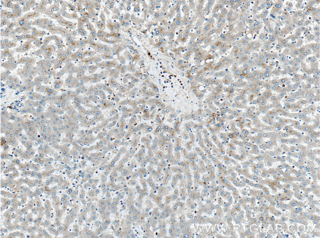 Factor XII Polyclonal antibody