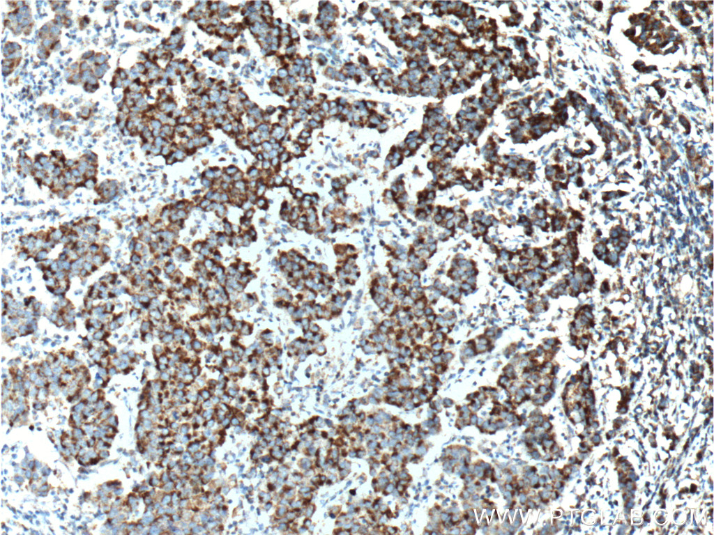 TBXA2R Polyclonal antibody
