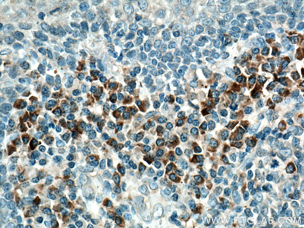 IL-23R Polyclonal antibody