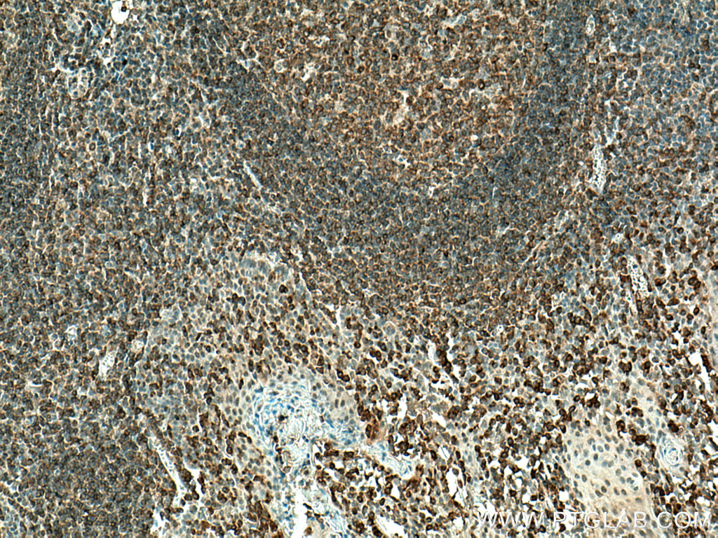 PLCG2 Polyclonal antibody