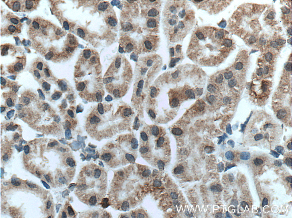 TMIGD1 Polyclonal antibody