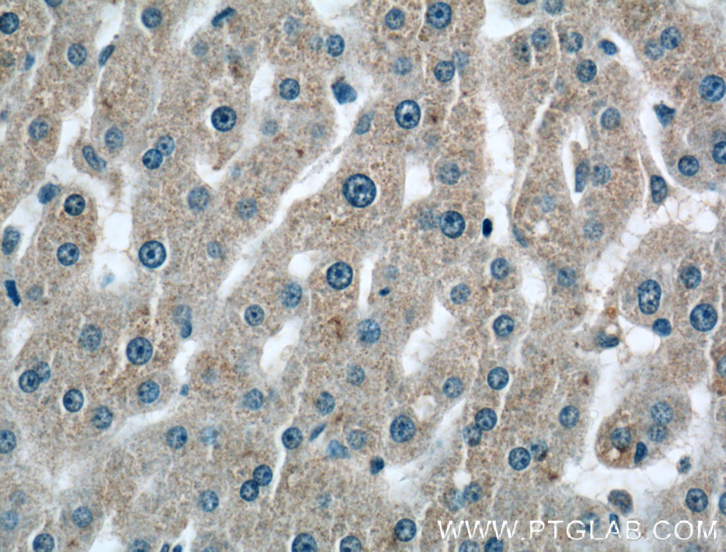 C2 Polyclonal antibody
