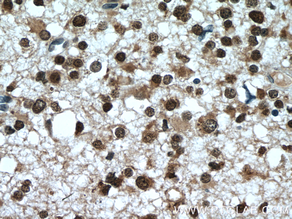 MSI1 Polyclonal antibody
