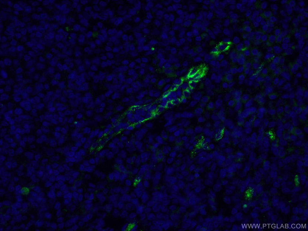 VWF Polyclonal antibody