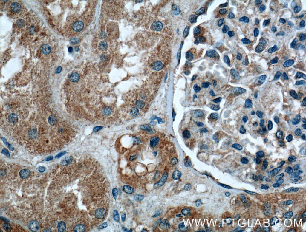 Integrin Alpha 6 Polyclonal antibody