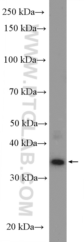 CCDC92 Polyclonal antibody