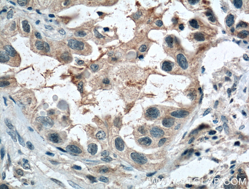 CCDC8 Polyclonal antibody