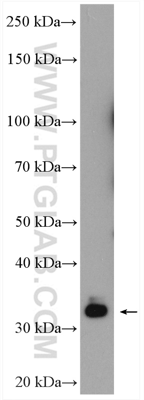 EHF Polyclonal antibody