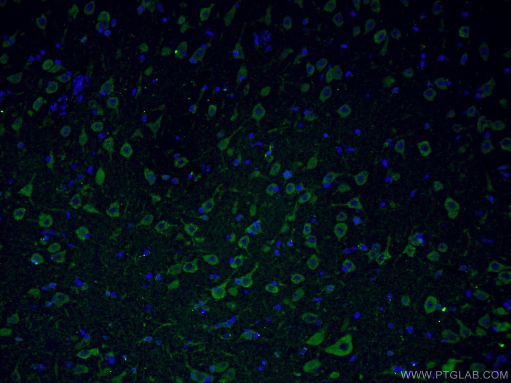 Huntingtin Polyclonal antibody
