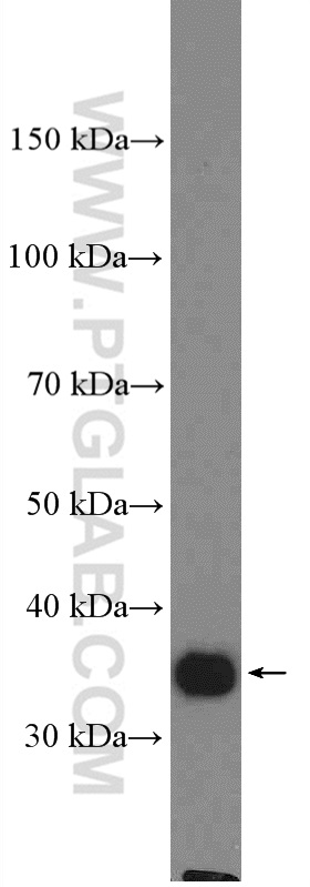 LRRC59 Polyclonal antibody