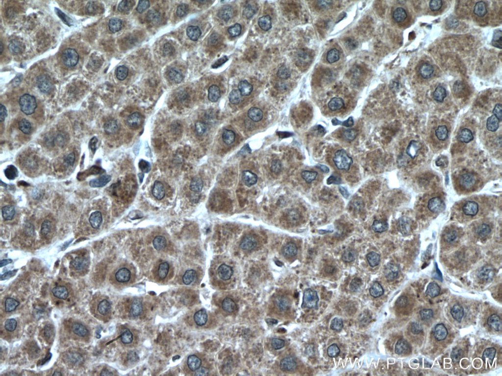 KIF13A Polyclonal antibody