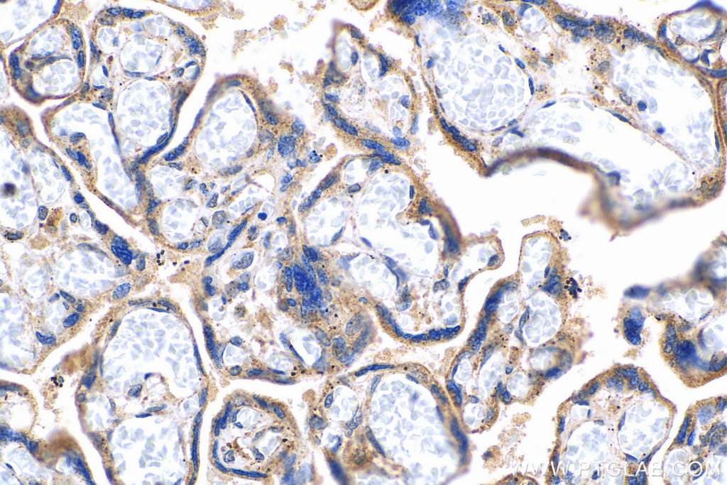 TGFBR2 Polyclonal antibody