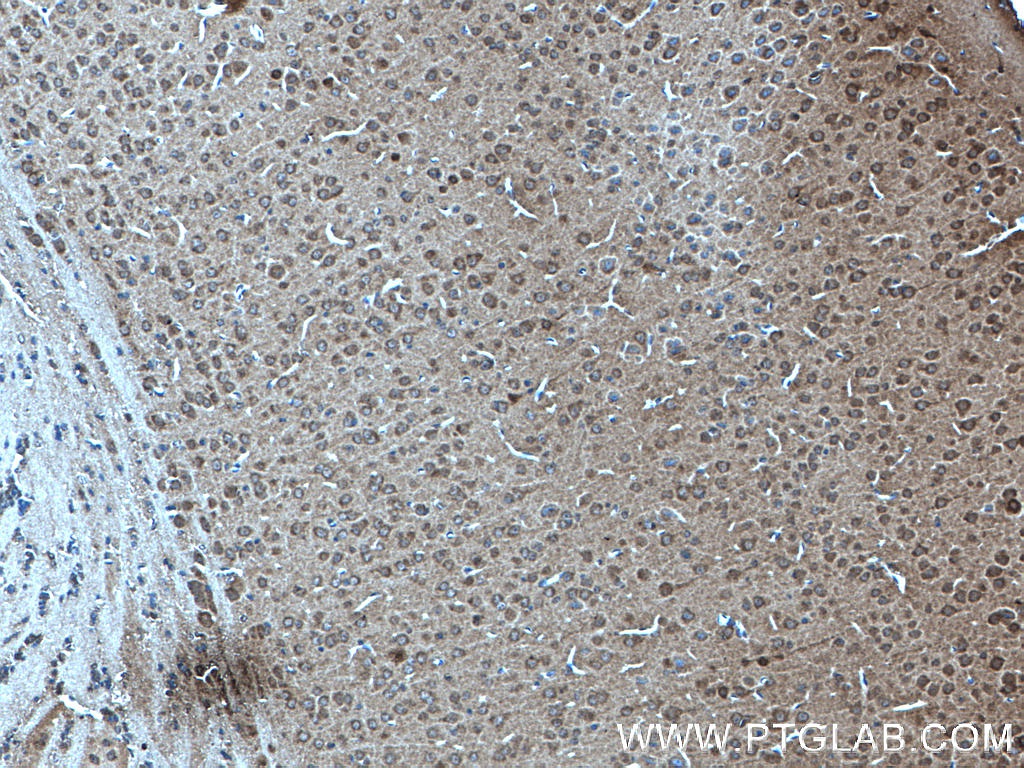 KIF2A Polyclonal antibody