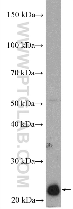 RAB5C Polyclonal antibody