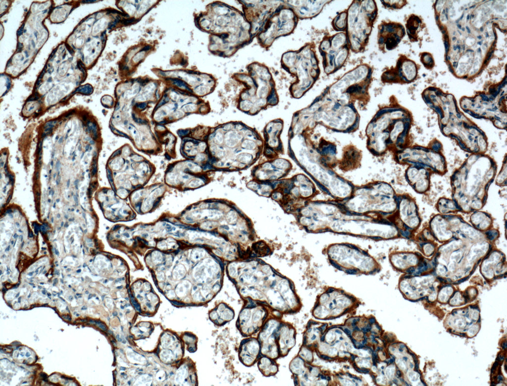 Integrin Alpha 5 Polyclonal antibody