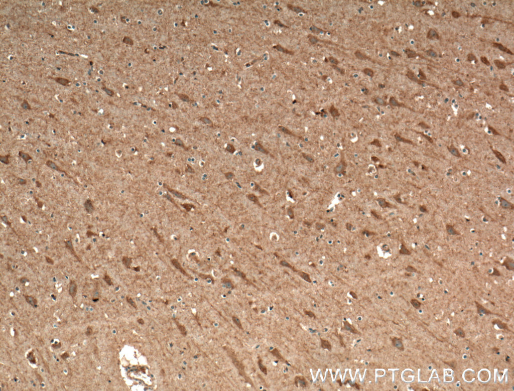 CACNA1E Polyclonal antibody