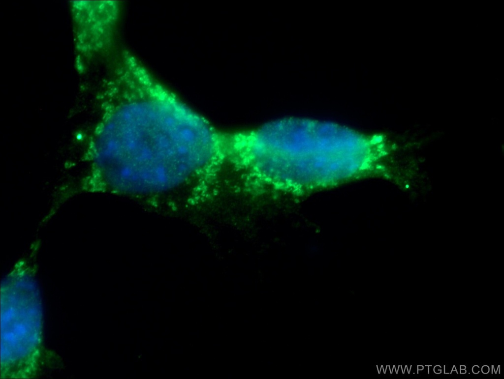 RICTOR Polyclonal antibody