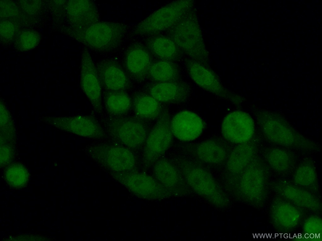Neurofibromin 1 Polyclonal antibody