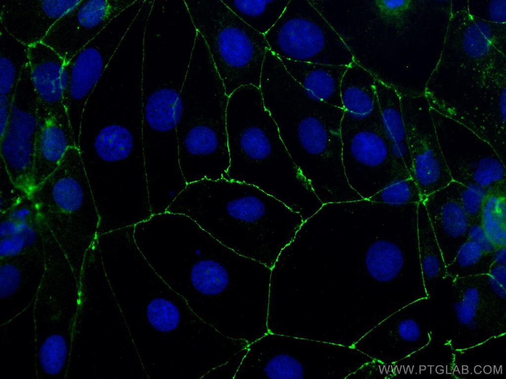 Occludin Polyclonal antibody