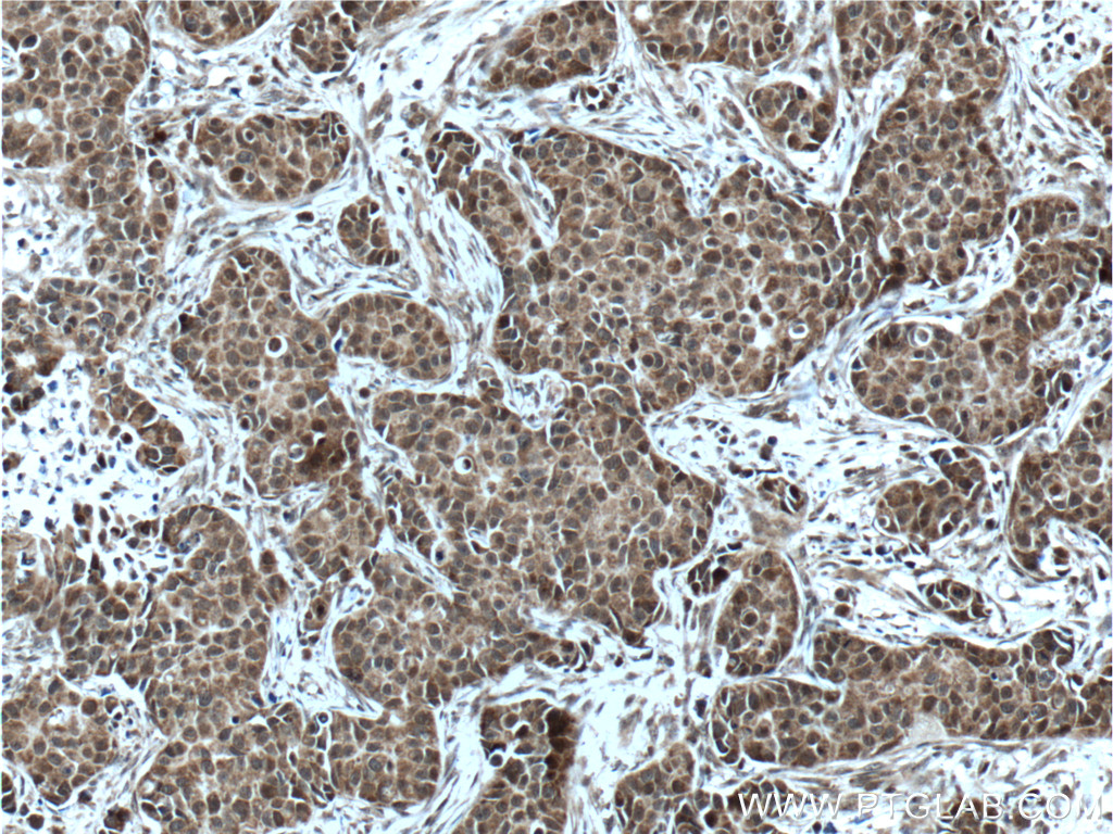 KMT2D Polyclonal antibody