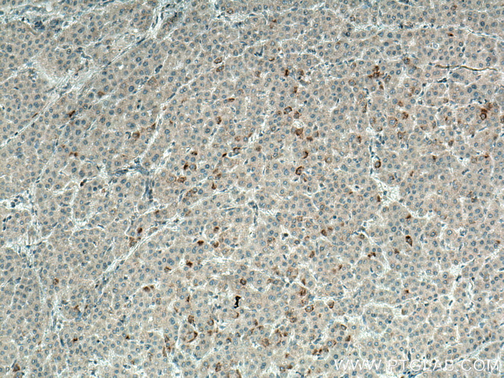 BCRP,ABCG2 Polyclonal antibody