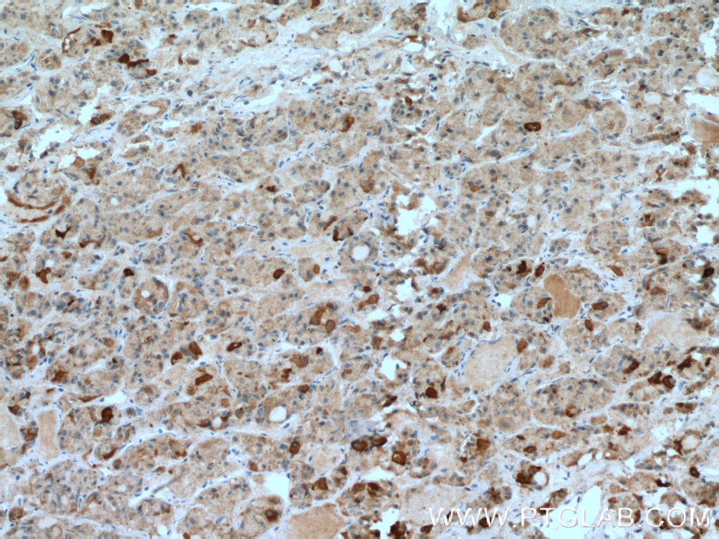 TSH Beta Polyclonal antibody